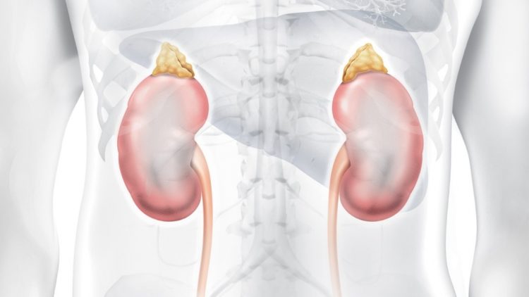 Pedras nos rins: causas, sintomas e tratamentos