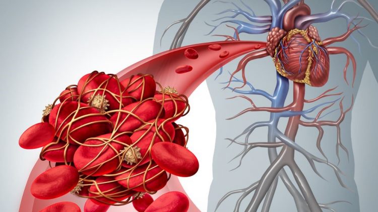 8 problemas comuns de má circulação sanguínea e como evitá-los