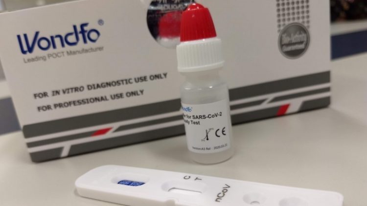 Governo distribuirá 25 mil testes rápidos para identificar casos de coronavírus