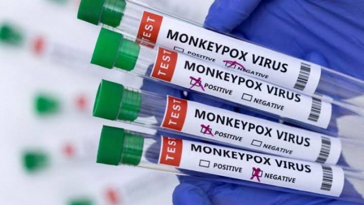 Exame laboratorial confirma segundo caso de Monkeypox no RS
