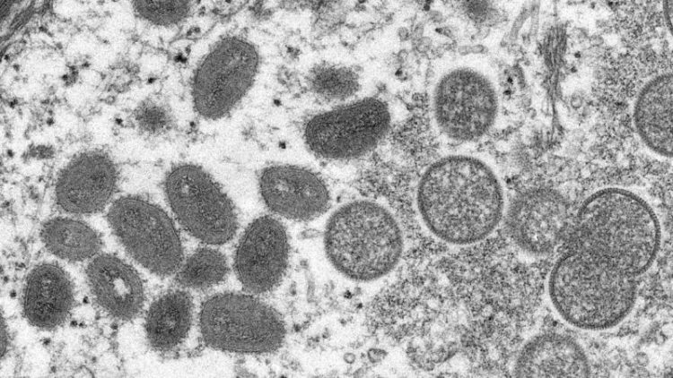 Vigilância do Estado monitora caso suspeito da varíola do macaco